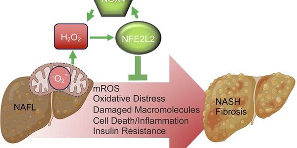 Article teaser image