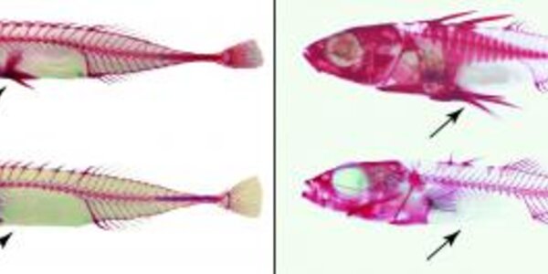 Article teaser image