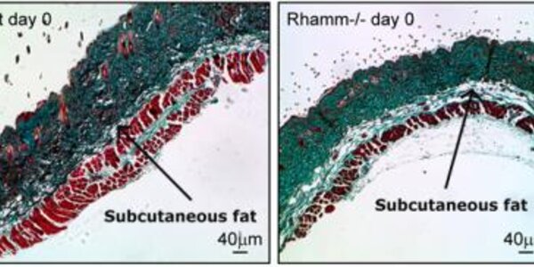 Article teaser image