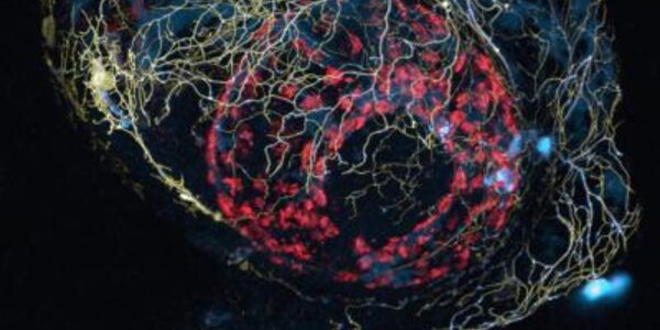 Article teaser image