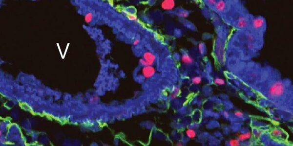 Article teaser image