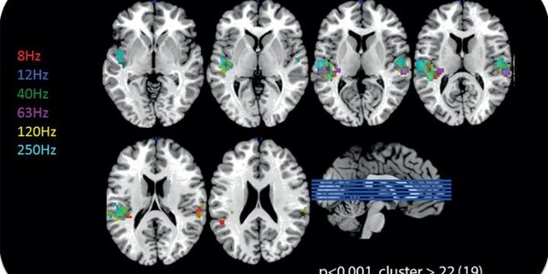 Article teaser image