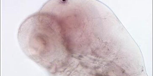 Article teaser image