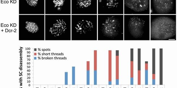 Article teaser image