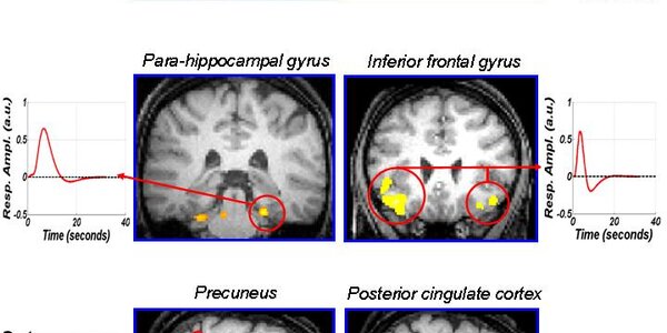 Article teaser image