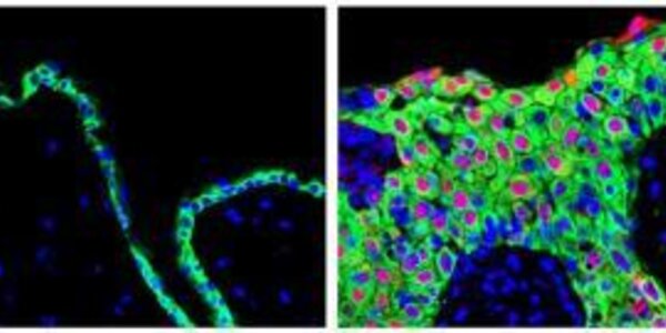 Article teaser image