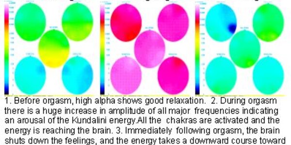 Article teaser image