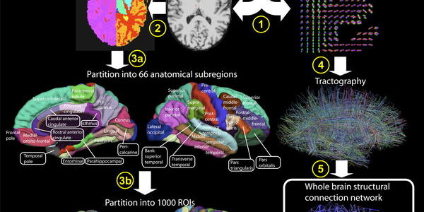 Article teaser image