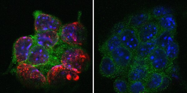 Article teaser image