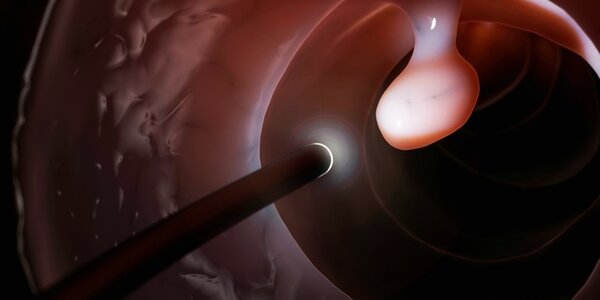 Article teaser image