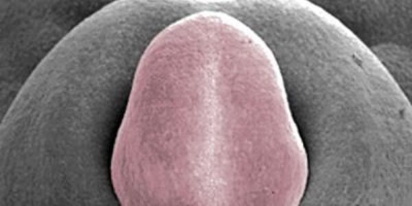 Article teaser image