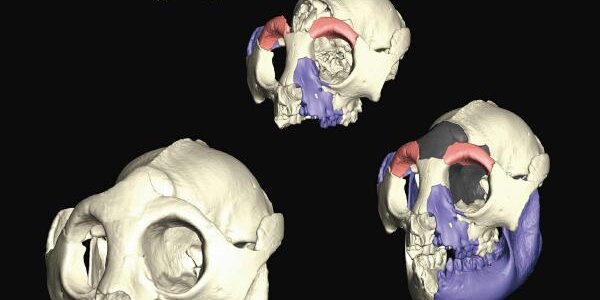 Article teaser image