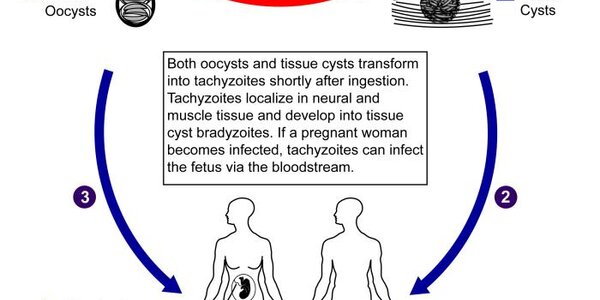 Article teaser image