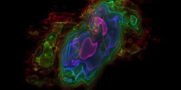 Article teaser image