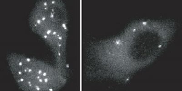 Article teaser image