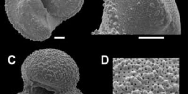 Article teaser image