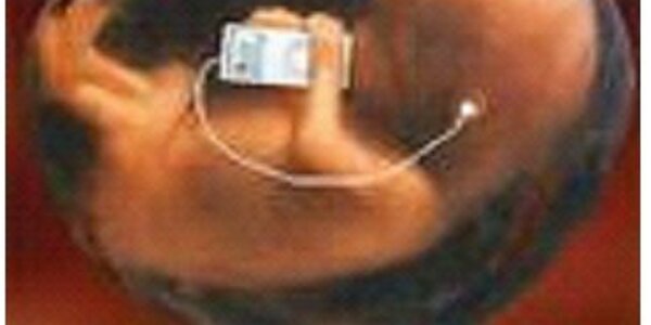 Article teaser image