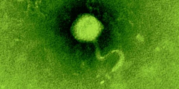 Article teaser image