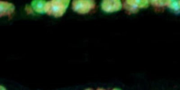 Article teaser image