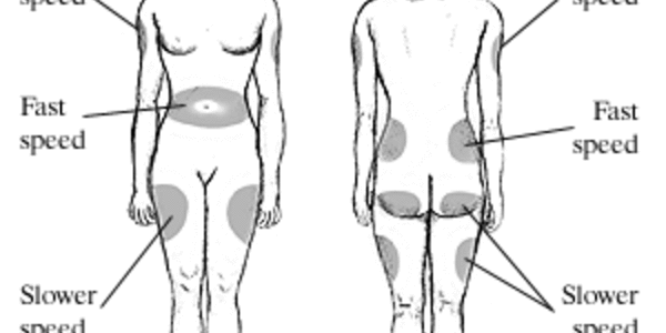 Article teaser image