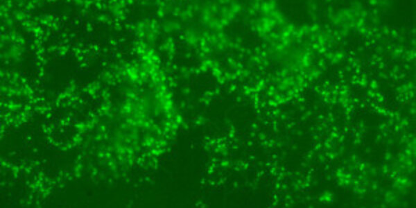 Article teaser image