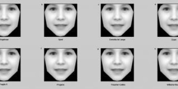 Article teaser image