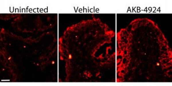 Article teaser image