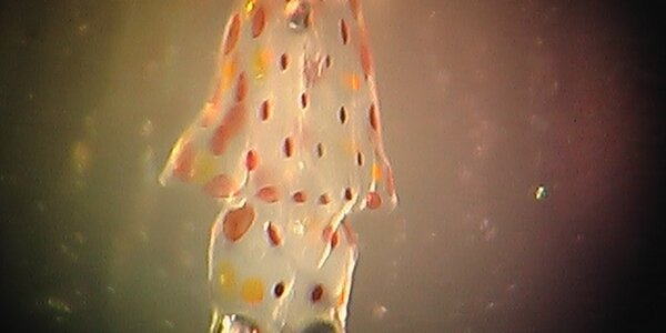 Article teaser image