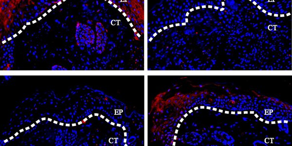 Article teaser image
