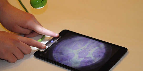 Article teaser image