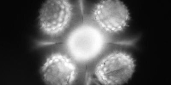 Article teaser image