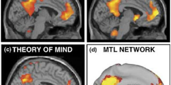 Article teaser image