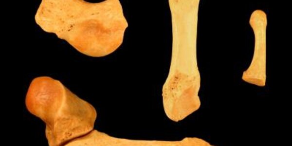 Article teaser image