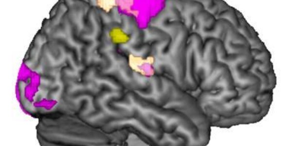 Article teaser image