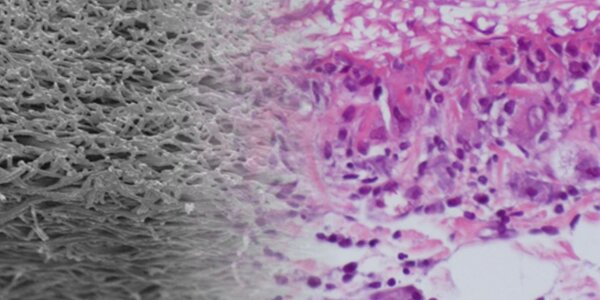 Article teaser image