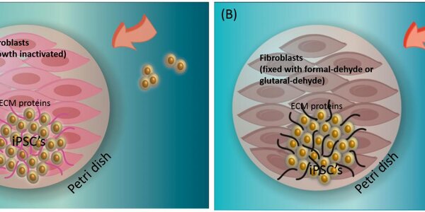 Article teaser image