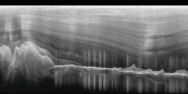 Article teaser image