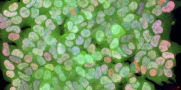 Article teaser image