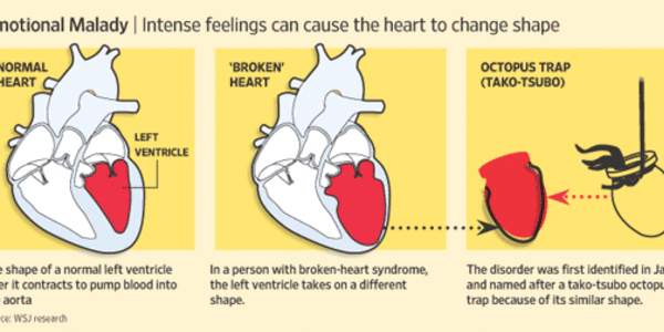 Article teaser image