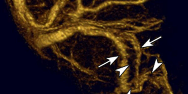 Article teaser image