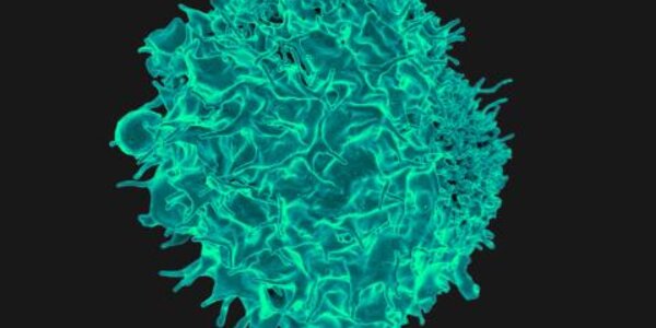 Article teaser image