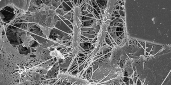 Article teaser image