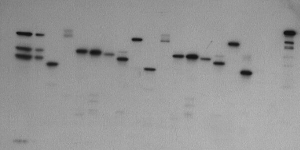 Article teaser image