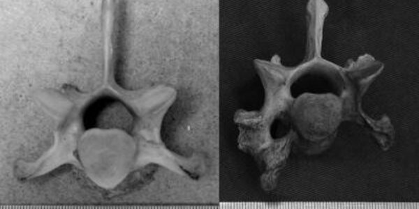 Article teaser image