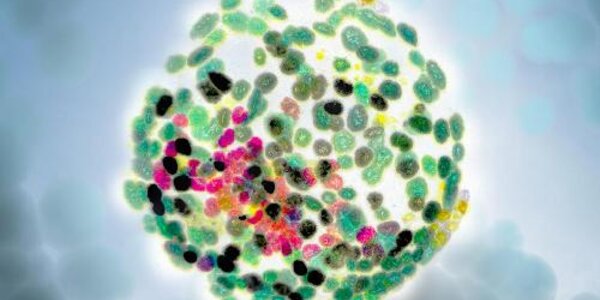 Article teaser image