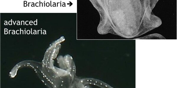 Article teaser image