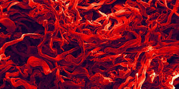 Article teaser image