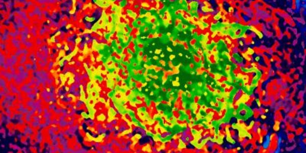 Article teaser image