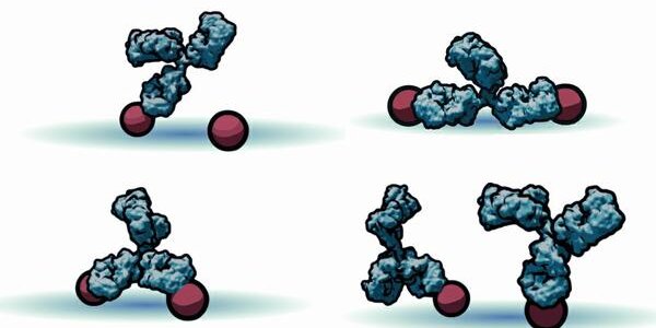 Article teaser image