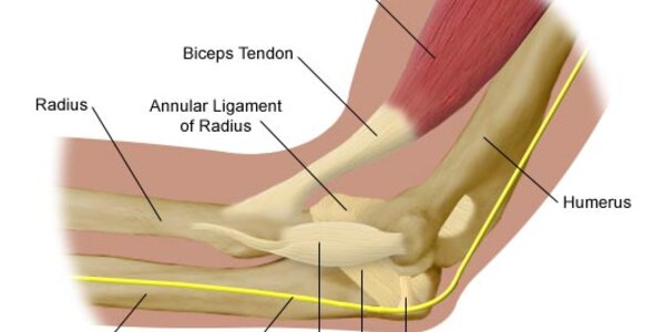 Article teaser image